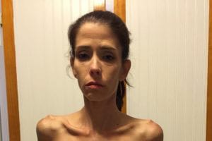 CVID Survivor Leaves Her Life in the Hands of Strangers