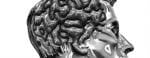 How to Stimulate Your Brain to Treat Dystonia