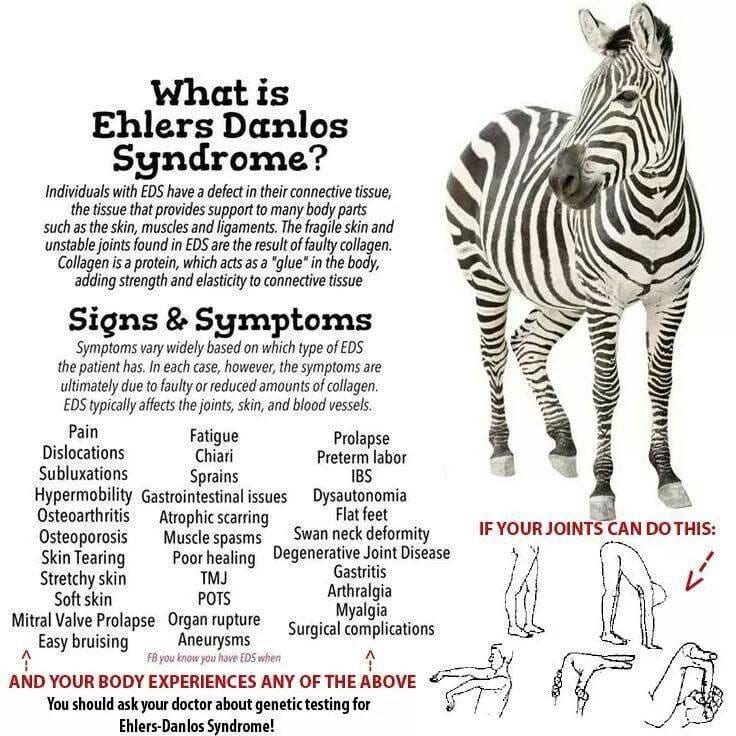 Zebra explaining Ehlers-Danlos Syndrome Infographic