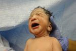 If Your Newborn Has CINCA, Then You Need to Read This