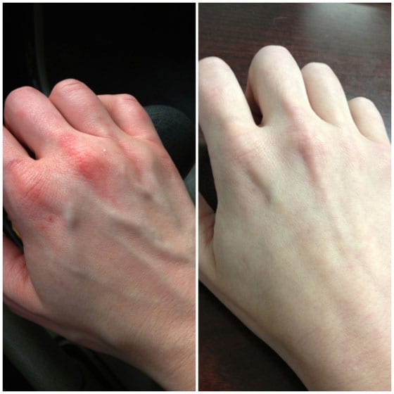 If Seeing Is Believing, This Mother Will Make You Believe In POTS