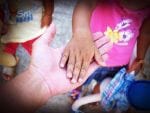 The Impact and Challenges of Caring for People with Tardive Dyskinesia 