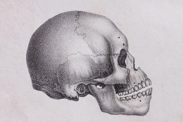 3-D Printed Skulls For Delicate Surgery Preparation