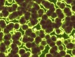 What You Need To Know About Commensals and APS