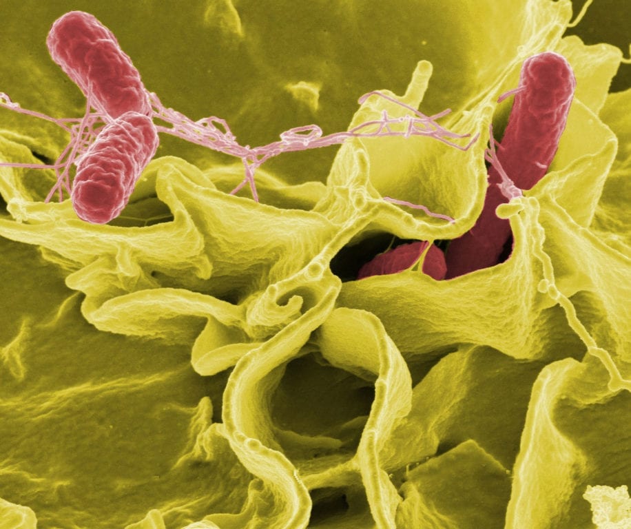 Does a Possible Multiple Sclerosis Treatment Lie in Gut Bacteria?