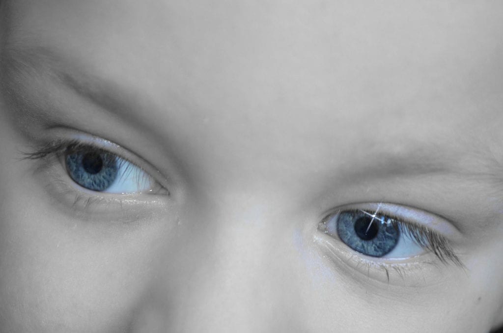What Angelman Syndrome Researchers Can Tell by Looking at Your Eyes