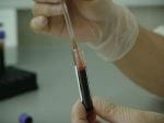 Get Tested for Zika Not Once, But Twice