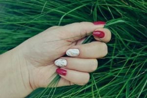 Do You Know the Signs of Marfan Syndrome? 50% of People with this Potentially Fatal Disease Don’t.