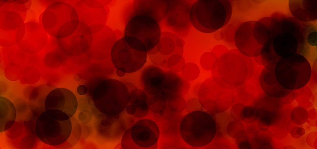 New Trial for sGC Stimulator Treatment for Sickle Cell Disease