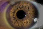 Wet Macular Degeneration: X-82 Clinical Trial Stopped Over Toxicity Issues