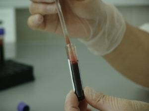 Blood Test Could Have Saved the Life of a Boy With Addison’s Disease
