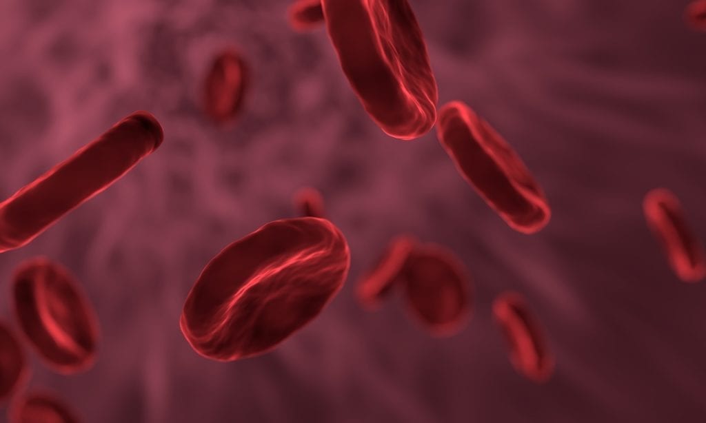 First Hemophilia B Patient Enrolled in Potential Breakthrough Phase III Trial