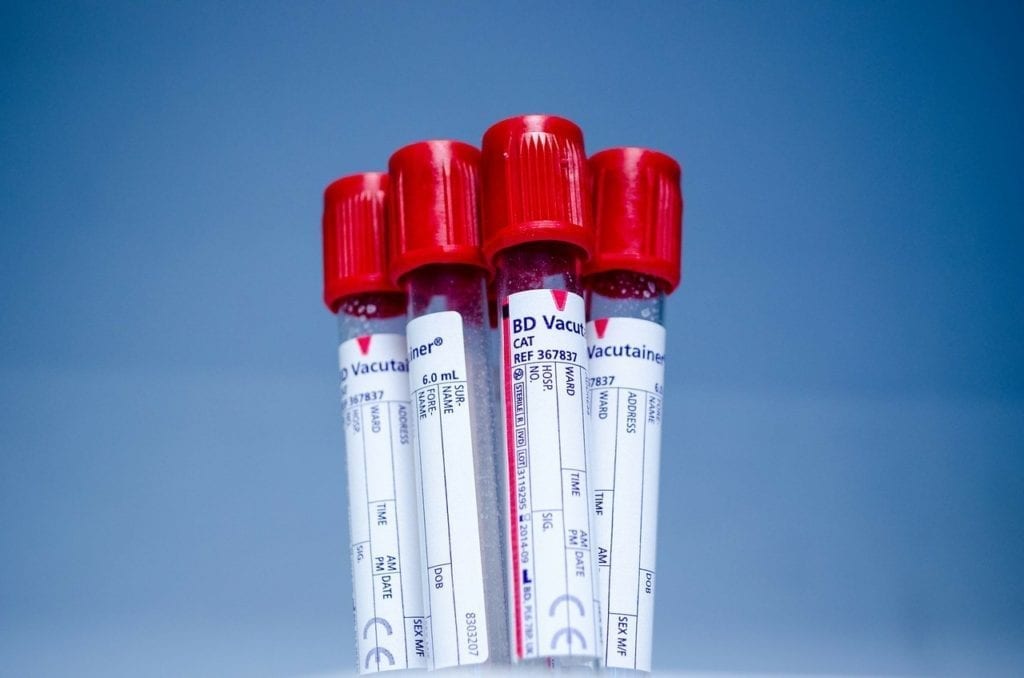 Universal Blood Test Could Revolutionize Cancer Diagnosis