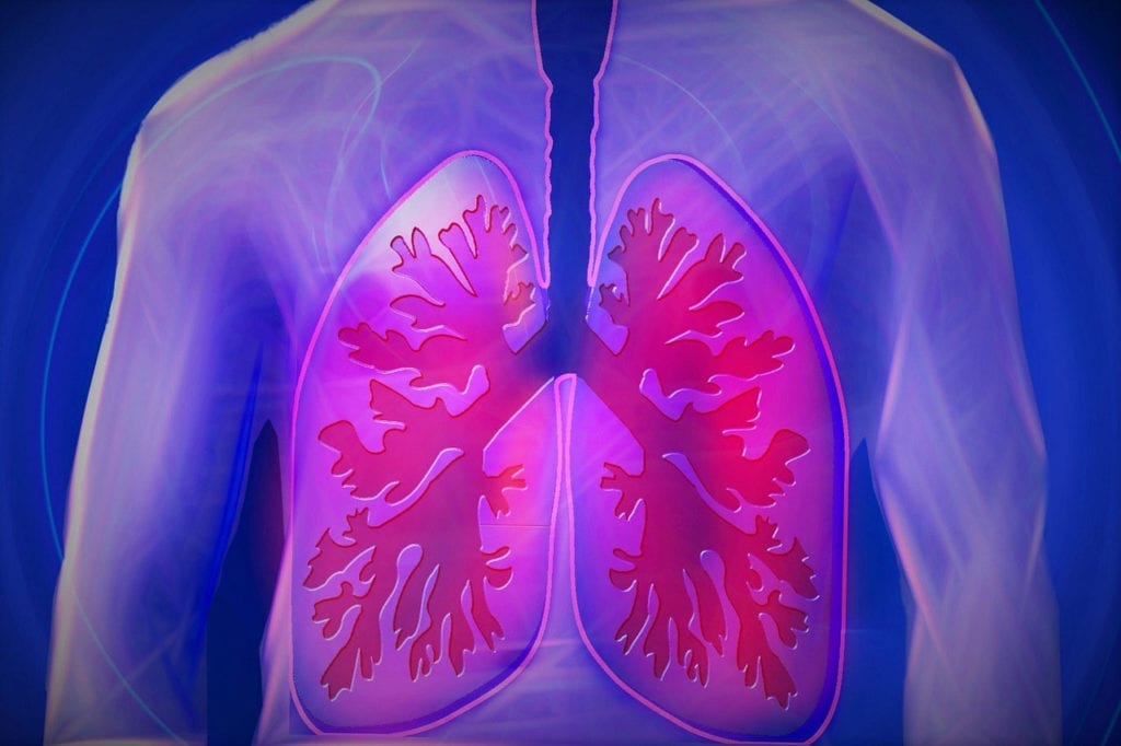 The NIH Has Granted $8.9 million to Researchers Investigating a Drug For Idiopathic Pulmonary Fibrosis