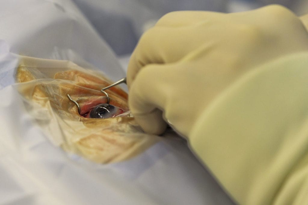 Corneal Transplants Are Used to Treat These Eye Conditions