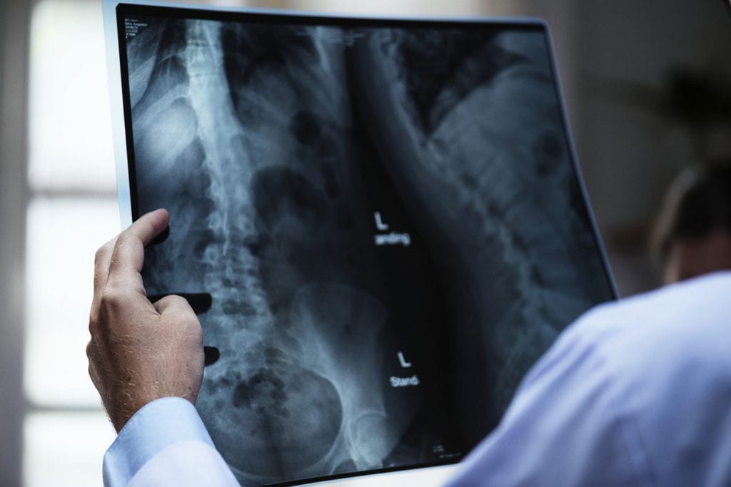 La Subvención de $3.7 Millones Financiará la Investigación de la Osteopetrosis Infantil Maligna