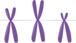 A Gene Therapy for Sickle Cell Disease has Been Approved for an Investigational New Drug Application by the FDA