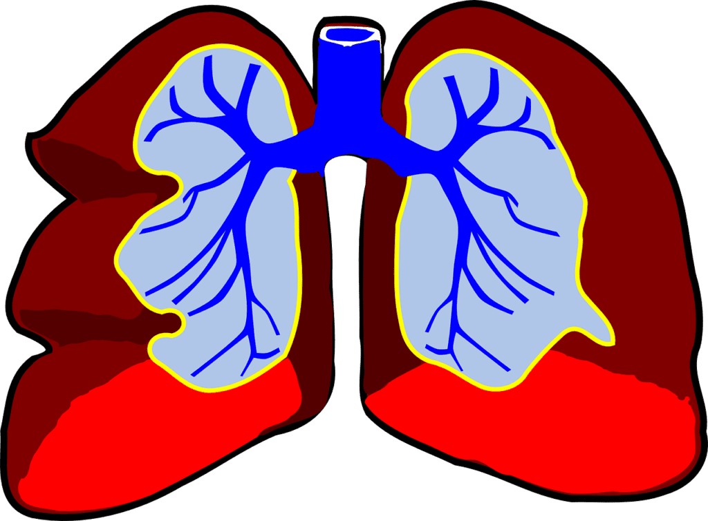 Study Found Ziritaxestat Ineffective in Improving IPF Lung Function