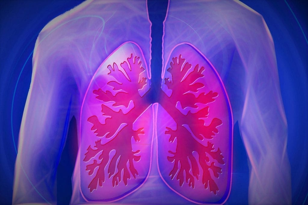 The First Patient Has Been Dosed in a Study of a Drug For Idiopathic Pulmonary Fibrosis