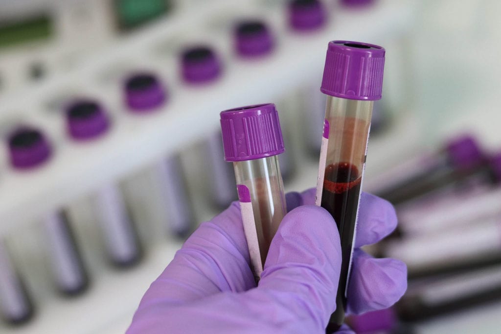 Blood Test Could Help Bring Personalized Treatment for Cystic Fibrosis
