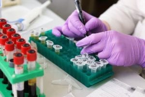 Posible Tratamiento para La Atrofia Muscular Espinal Obtiene la Designación PRIME de la EMA