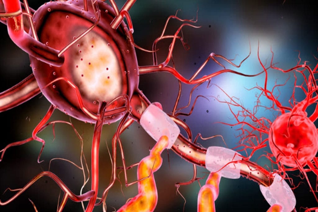 Stem Cells Could Form New Myelin in Multiple Sclerosis Patients