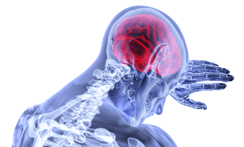 Stroke Warning Issued by the FDA for Multiple Sclerosis Drug