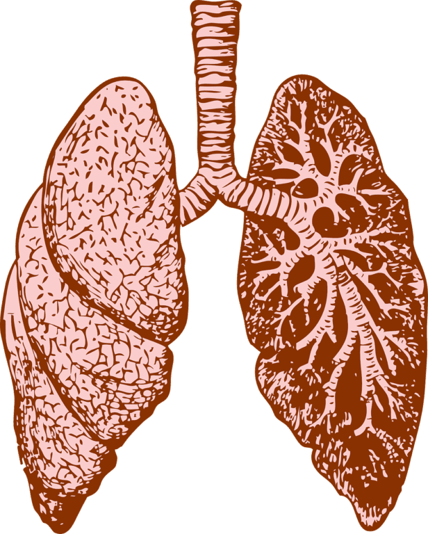 New Potential Treatment for Pulmonary Sarcoidosis Enters Phase 1b/2a Trial