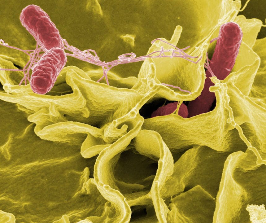 Los Científicos Descubren Cómo las Bacterias que se Alimentan de la Carne Prosperan Dentro de Nuestros Cuerpos