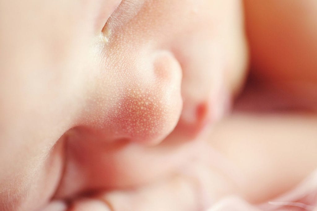 Newborn Screening May Add More Rare Diseases in Virginia
