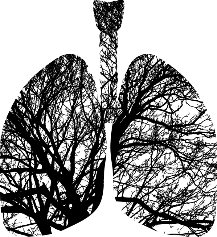 Common Antifungal Drug Shows Promise in Treating Cystic Fibrosis