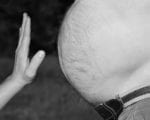 A New Drug With the Potential to Treat Hypothalamic Obesity