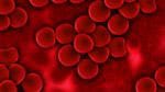 Extremely Positive Results Announced from Interim Analysis of Phase 2 Clinical Trial for Hemochromatosis