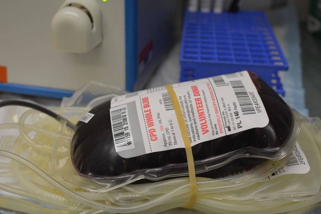 ¿Se puede donar sangre con un diagnóstico de enfermedad de Lyme?