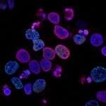 Researchers Find Immunotherapy Drug May Treat Pheochromocytoma