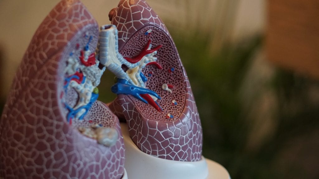 AI Can Predict How COVID-19 Might Progress to Acute Respiratory Distress Syndrome