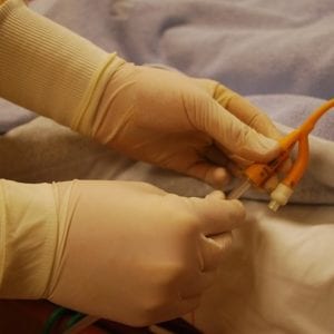 The FDA Grants Approval to JELMYTO For Upper Tract Urothelial Cancer