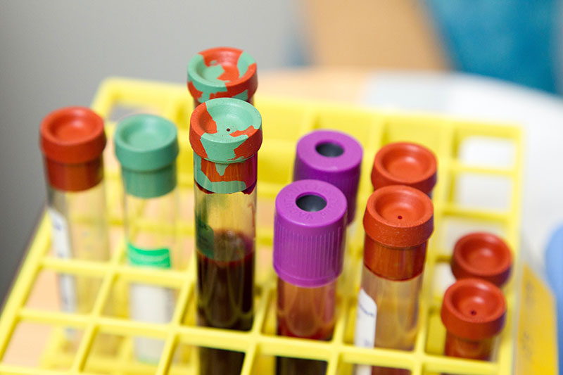 Nuevas expectativas clínicas necesarias para tratar la hemofilia