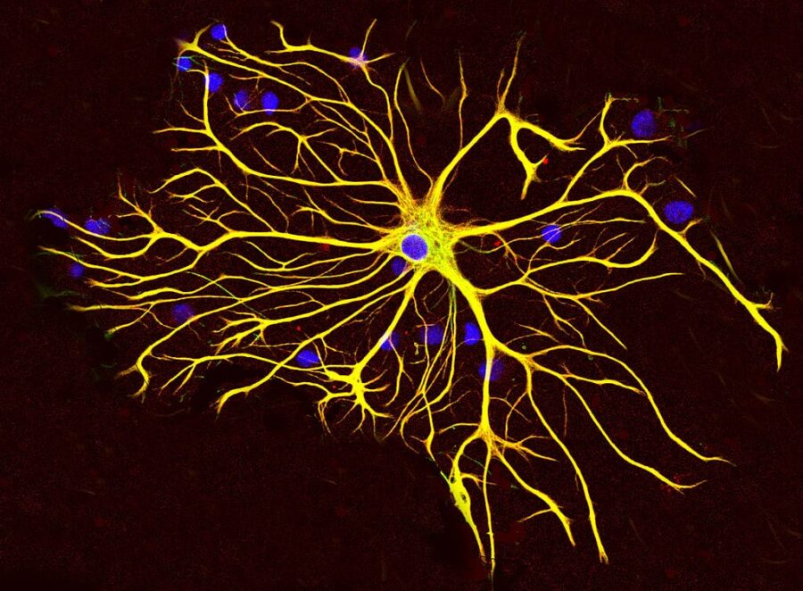 How Rogue Astrocytes Cause Neurodegeneration