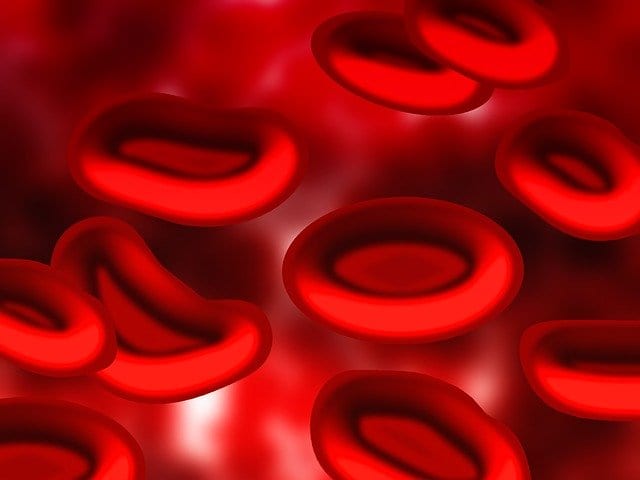 Positive Results in IMR-687 Study for Sickle Cell Disease
