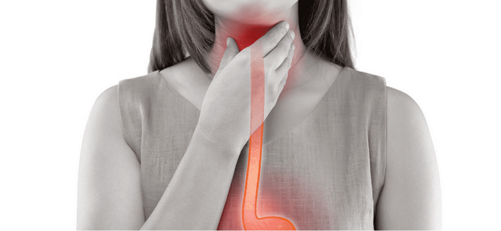 Early Weight Loss Linked to Lower Gastroesophageal Junction Carcinoma Survival Rates
