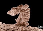 An Early Dose of Dexamethasone Can Prevent Long Term Effects of Bacterial Meningitis