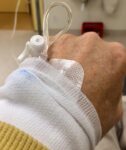 Non-Muscle Invasive Bladder Cancer: Adverse Events in Immunotherapy