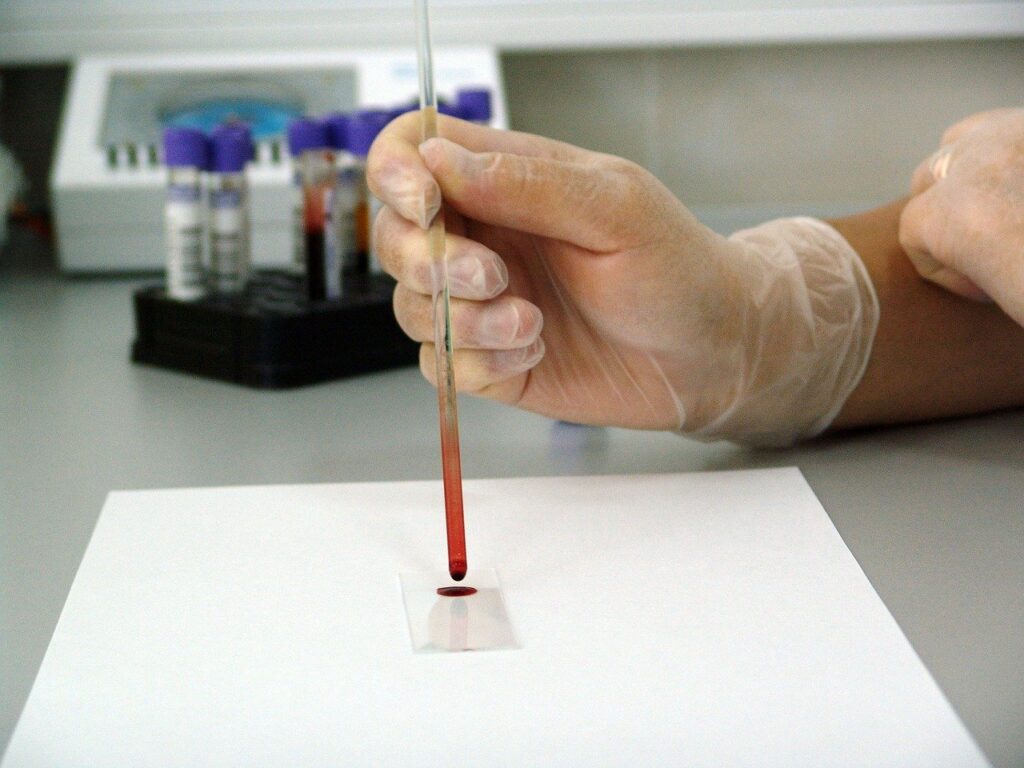 Researchers Are Developing a Glioblastoma Blood Test