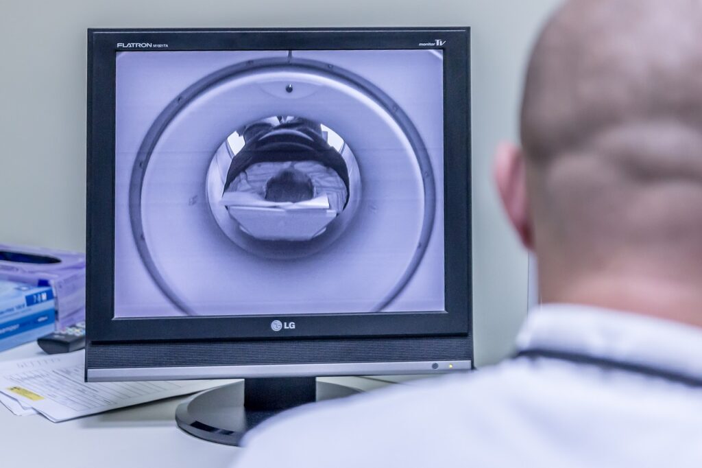 Ankylosing Spondylitis: Filgotinib May Help Treat MRI Lesions