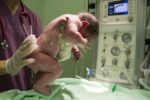 The Critical Role of Newborn Screenings