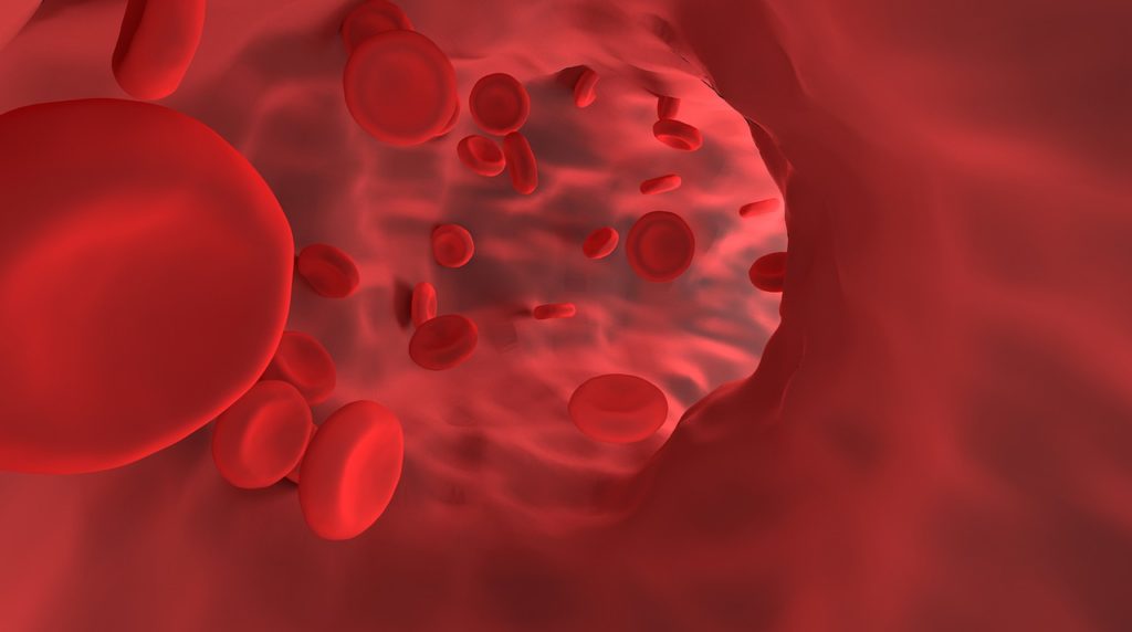 Researchers Are Working to Better Understand Paroxysmal Nocturnal Hemoglobinuria