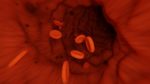 FDA Grants Rare Pediatric Disease Designation for Experimental Beta Thalassemia Drug