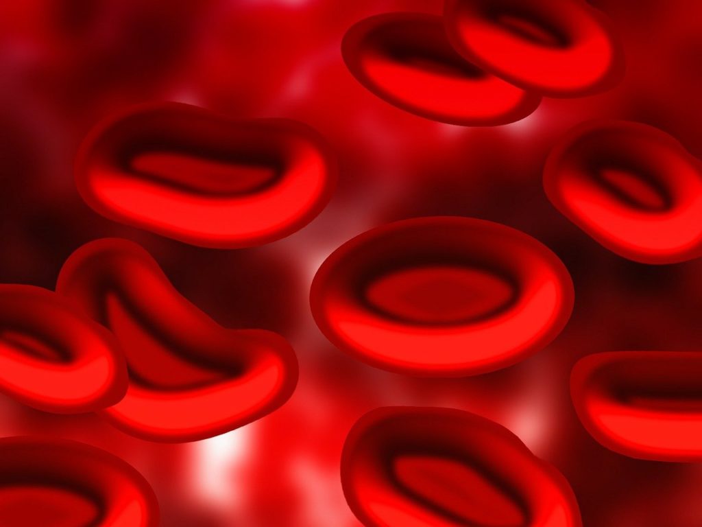 Two Novel Sickle Cell Disease Treatments Have Received Orphan Drug and Rare Pediatric Disease Designation
