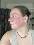 One of 50 People Worldwide: Why Kyla is Passionate about Raising Gleich Syndrome Awareness (Pt. 1)